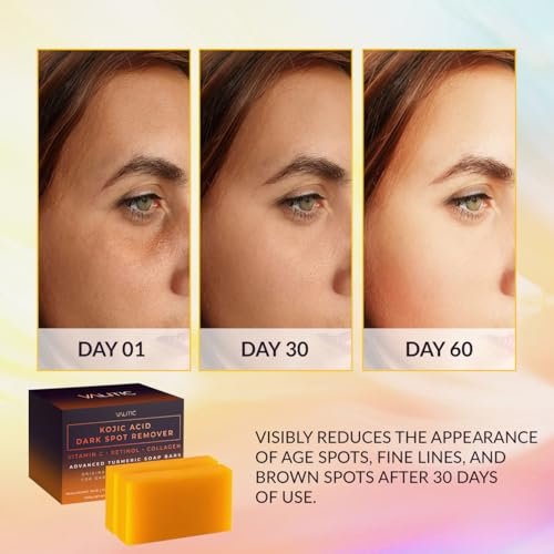 VALITIC Kojic Acid Dark Spot Remover Soap Bars with Vitamin C, Retinol, Collagen, Turmeric - Original Japanese Complex Infused with Hyaluronic Acid, Vitamin E, Shea Butter, Castile Olive Oil (2 Pack) : Beauty & Personal Care - Image 2